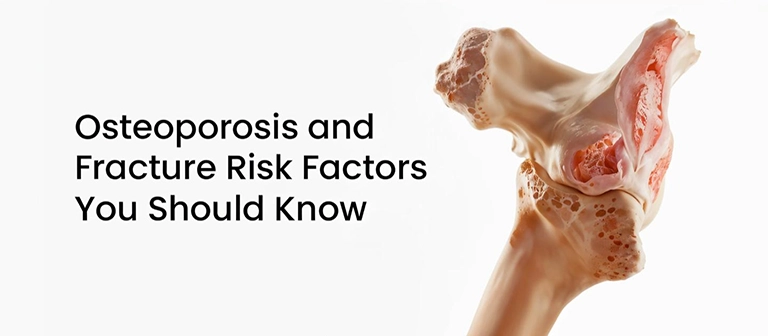 Understanding Osteoporosis: Key Risk Factors for Bone Fractures