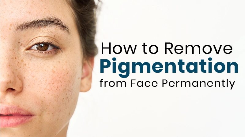 How to Remove Pigmentation from Face Permanently in Mumbai