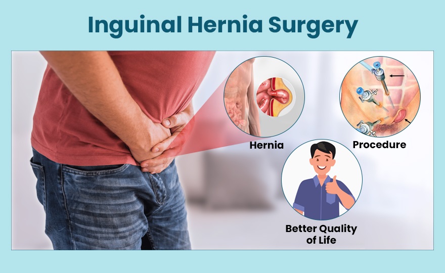 inguinal hernia surgery hospital in Greater Noida