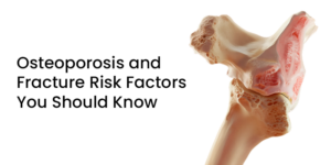 Read more about the article Osteoporosis and Fracture Risk Factors You Should Know